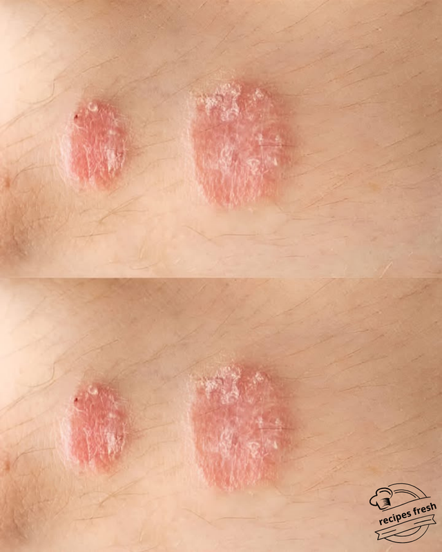 10 Common Skin Signs and What They Mean