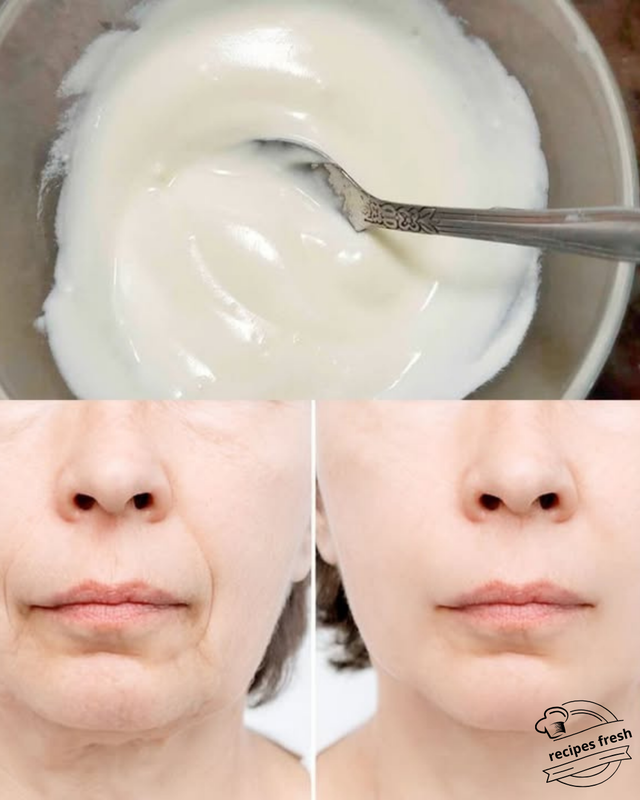 Baking Soda Face Cream: Eliminate Wrinkles and Spots with this Remedy