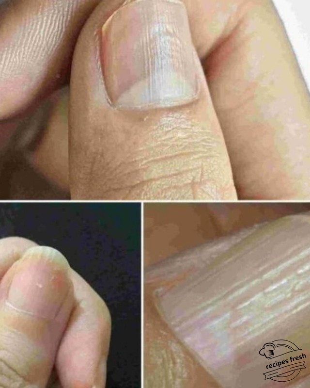 Understanding Your Nails: A Guide to the Lines and What They Mean